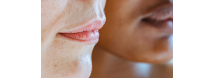 Pelle secca con il riscaldamento acceso? Ecco come mantenerla idratata